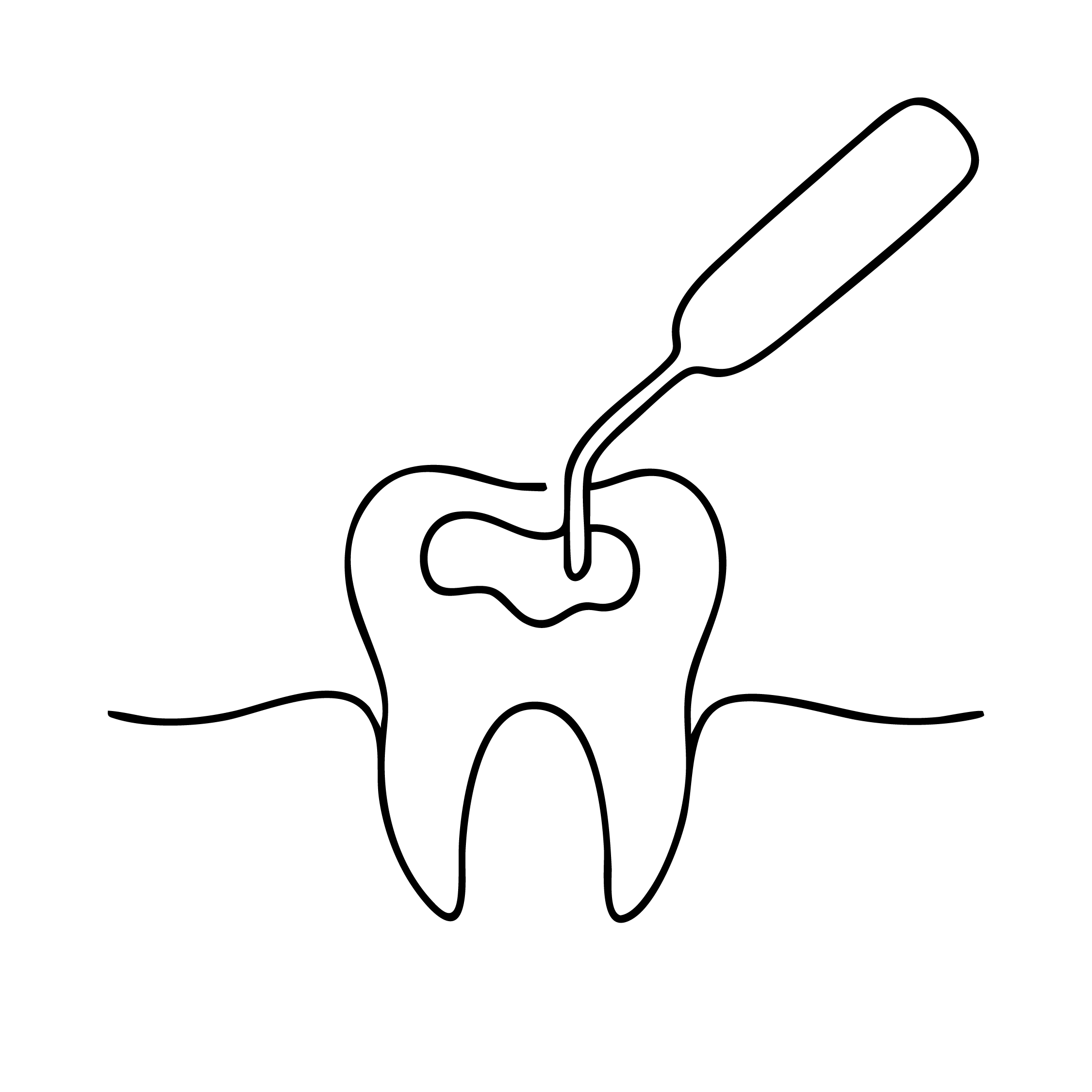 Hansi_Composite Füllung